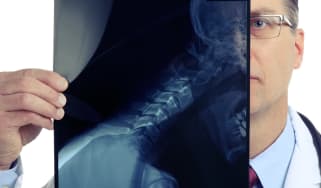 False whiplash claims wasting NHS hours