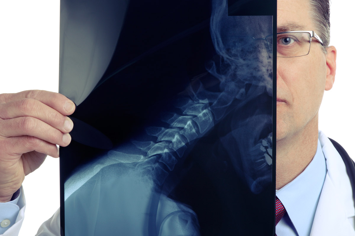 Whiplash report fees slashed to cut false claims  Auto 